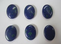 10pcs 13x18mm Azurite Malachite Oval Synthetic Cabochon Gemstones Resin Backing